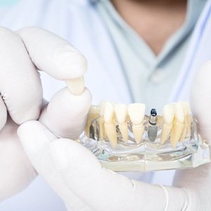 Close up of dentist holding a dental implant