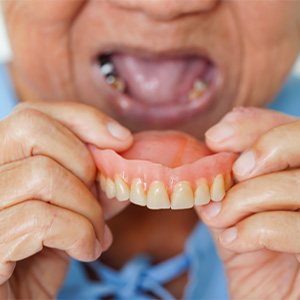 A woman who’s just removed her denture