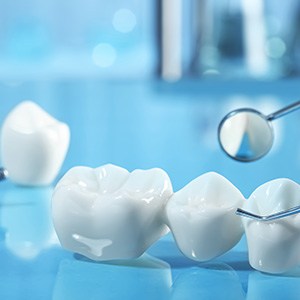 Parts of dental bridges and implants